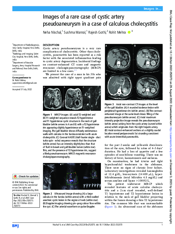 (PDF) Images of a rare case of cystic artery pseudoaneurysm in a case ...