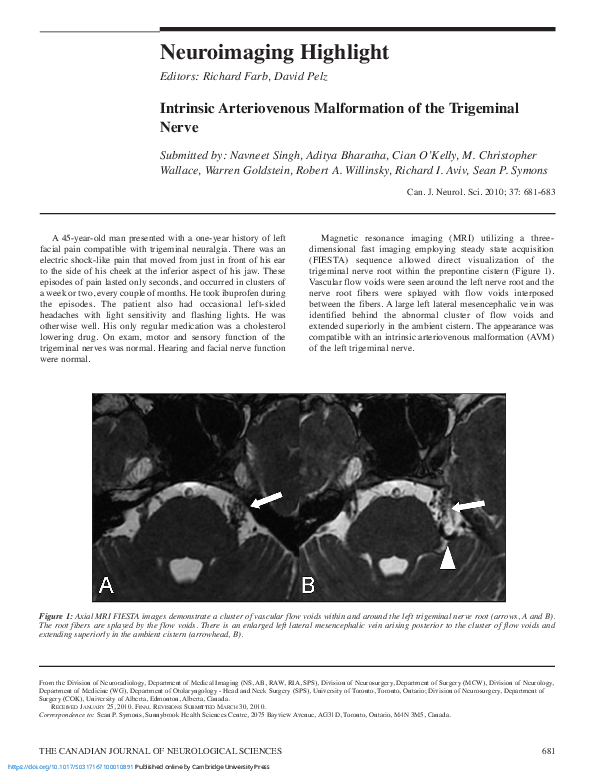 (PDF) Intrinsic Arteriovenous Malformation of the Trigeminal Nerve