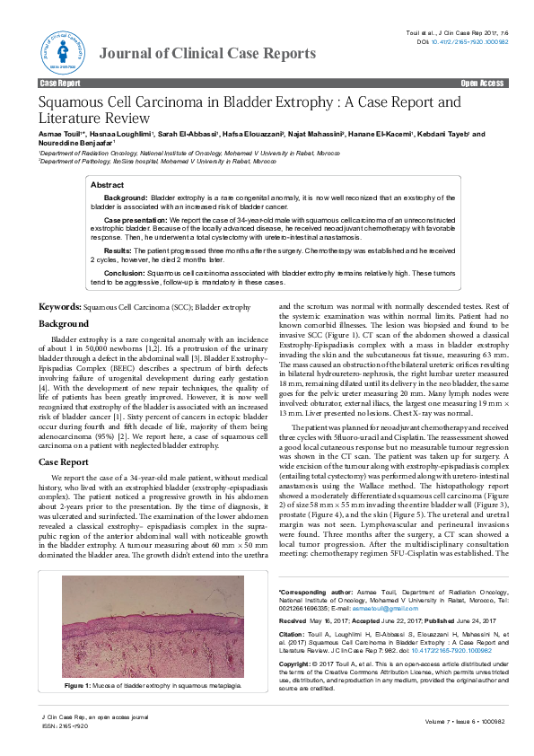 (PDF) Squamous Cell Carcinoma in Bladder Extrophy : A Case Report and ...