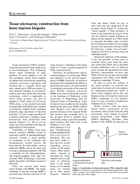 (PDF) Tissue microarray construction from bone marrow biopsies