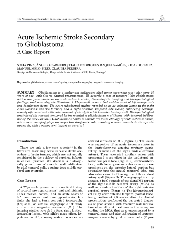 (PDF) Acute Ischemic Stroke Secondary to Glioblastoma