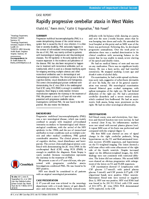 (PDF) Rapidly progressive cerebellar ataxia in West Wales