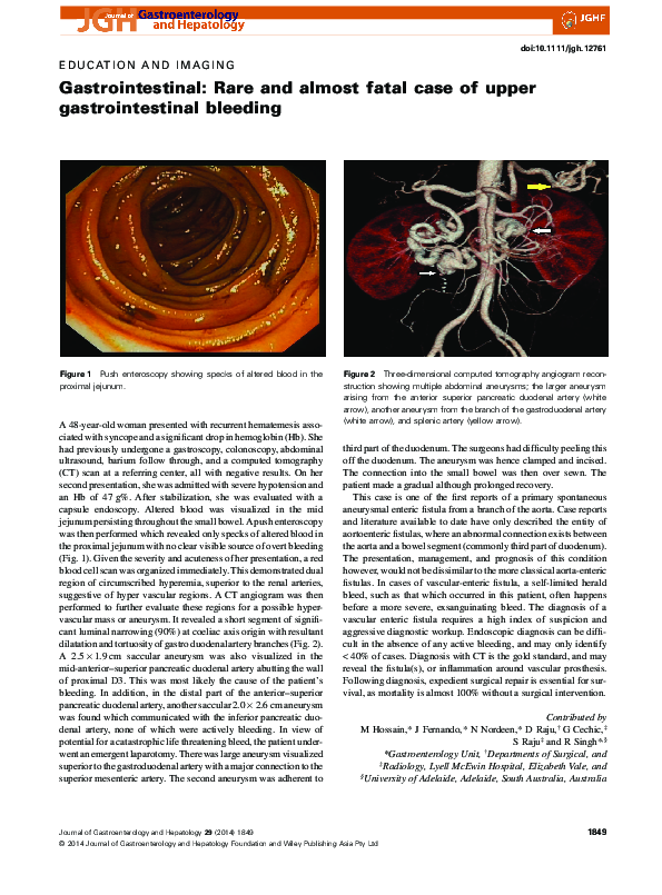 (PDF) Gastrointestinal: Rare and almost fatal case of upper ...