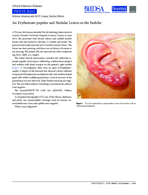 (PDF) An Erythemato-papular and Nodular Lesion on the Earlobe
