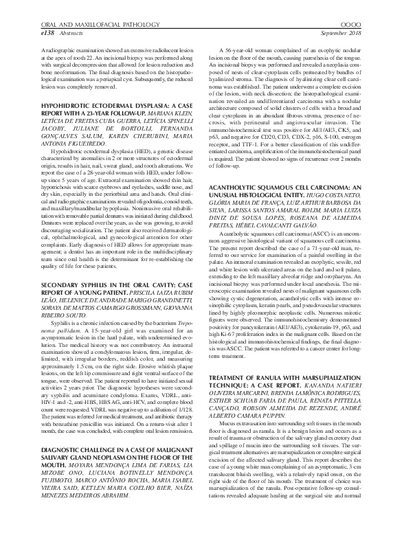 (PDF) Treatment of Ranula with Marsupialization Technique: a Case Report