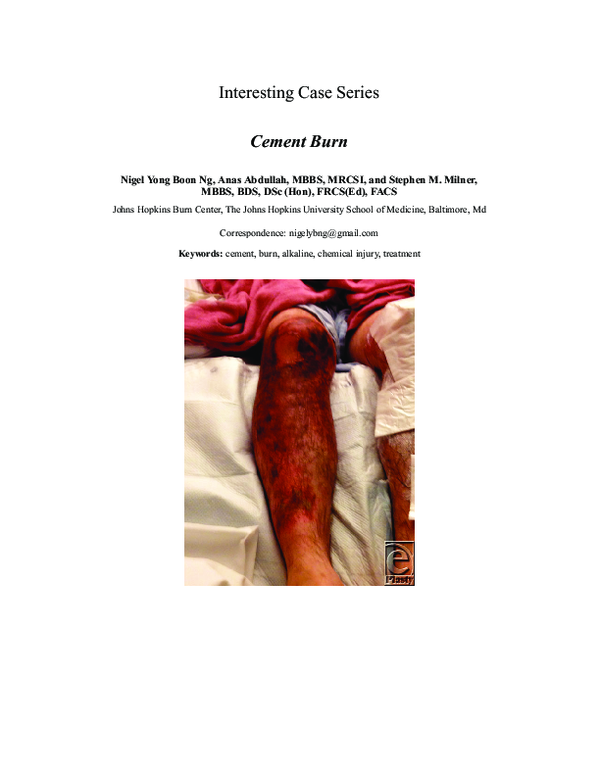 (PDF) Cement burn anas abdullah Academia.edu