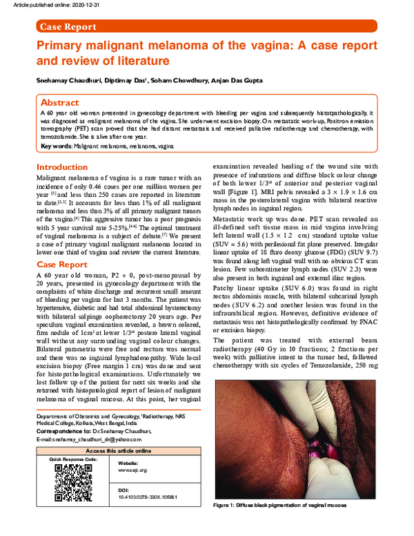 (PDF) Primary malignant melanoma of the vagina: A case report and ...