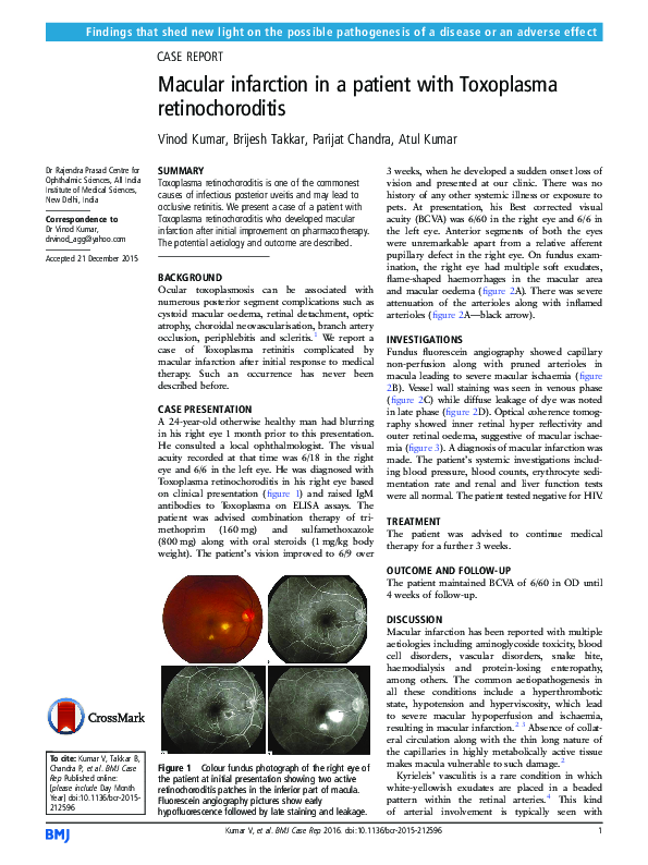 (PDF) Macular infarction in a patient with Toxoplasma retinochoroditis