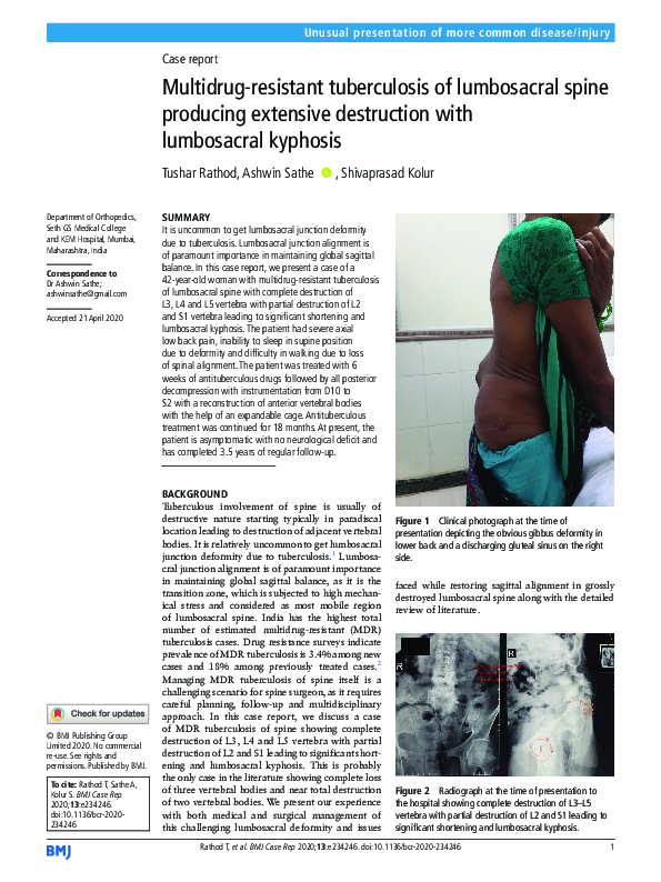(PDF) Multidrugresistant tuberculosis of lumbosacral spine producing