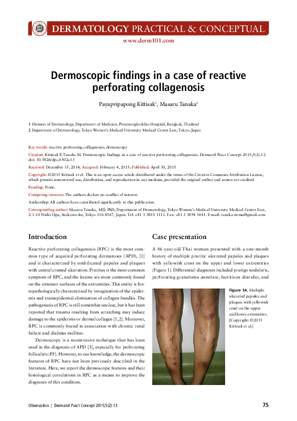 Perforating Folliculitis Dermoscopy
