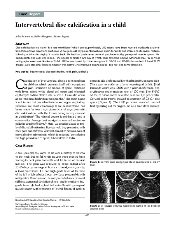 (PDF) Intervertebral disc calcification in a child