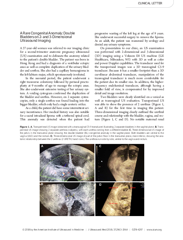 (PDF) A Rare Congenital Anomaly: Double Bladders on 2- and 3 ...