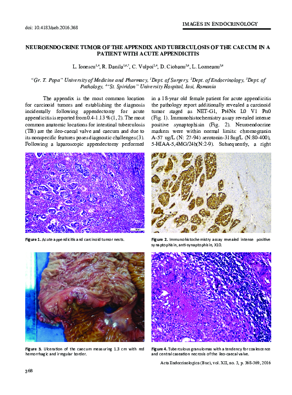 (PDF) Neuroendocrine Tumor of the Appendix and Tuberculosis of the ...