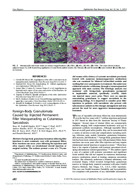 (PDF) Foreign-Body Granulomata Caused by Injected Permanent Filler ...