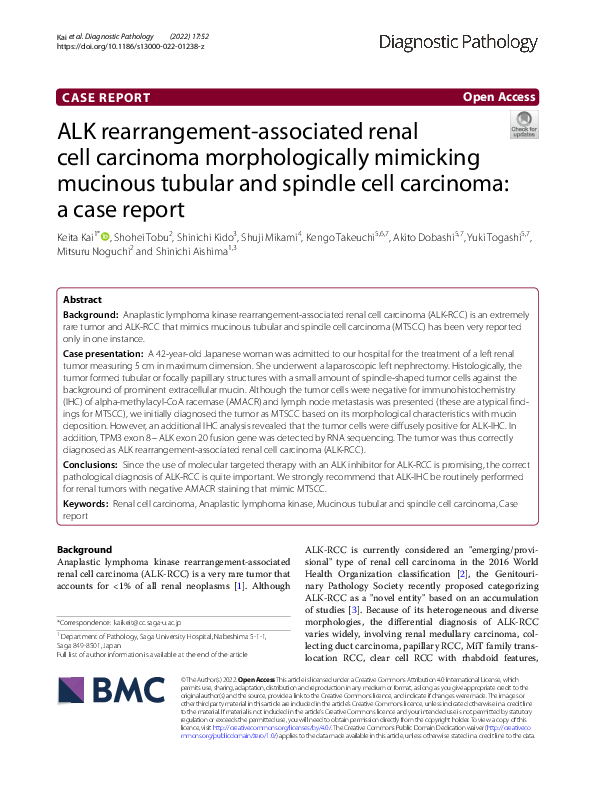 (PDF) ALK rearrangement-associated renal cell carcinoma morphologically ...