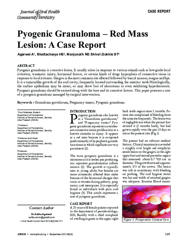 (PDF) Pyogenic Granuloma – Red Mass Lesion: A Case Report