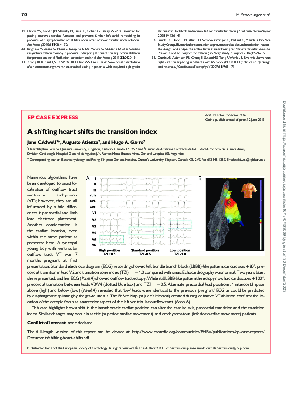 (PDF) A shifting heart shifts the transition index