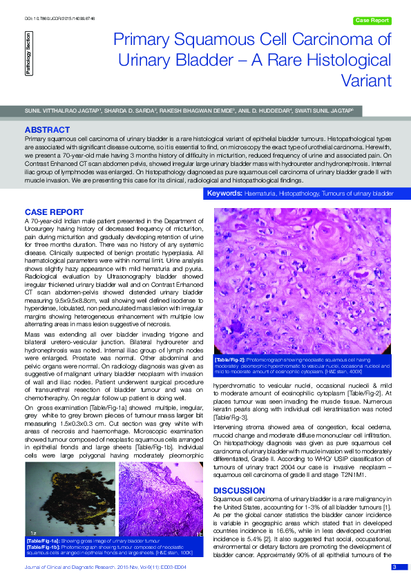 (PDF) Primary Squamous Cell Carcinoma of Urinary Bladder – A Rare ...
