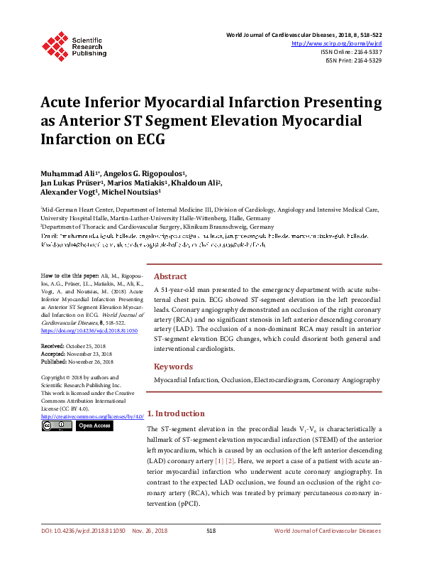 (PDF) Acute Inferior Myocardial Infarction Presenting as Anterior ST ...
