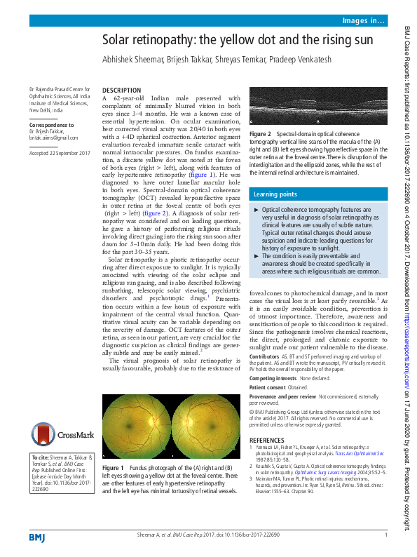 (PDF) Solar retinopathy: the yellow dot and the rising sun