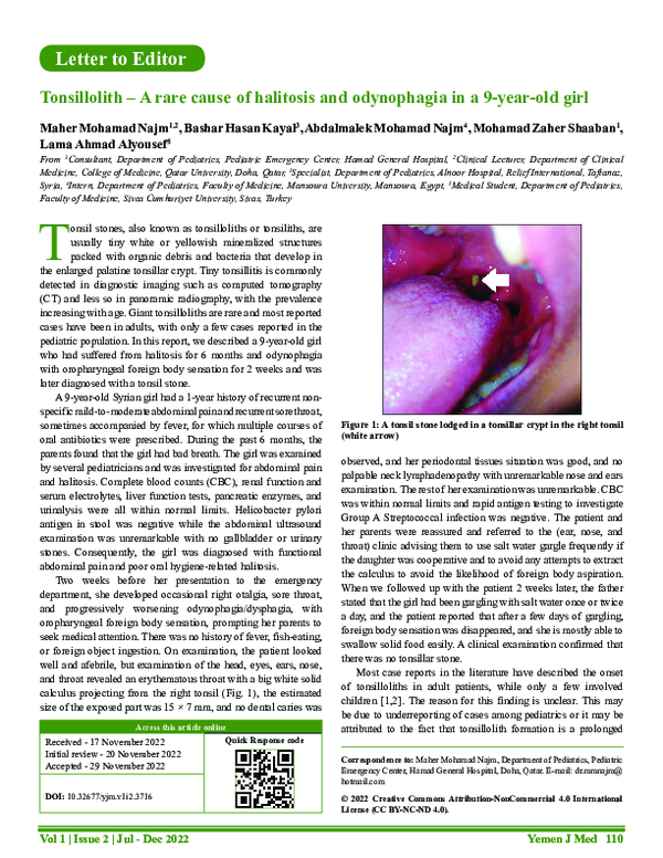 (PDF) Tonsillolith -A rare cause of halitosis and odynophagia in a 9 ...