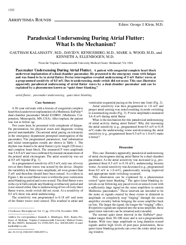 (PDF) Paradoxical Undersensing During Atrial Flutter: What Is the ...