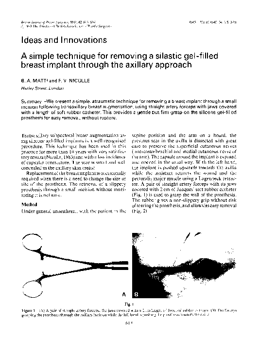 (PDF) A simple technique for removing a silastic gel-filled breast ...