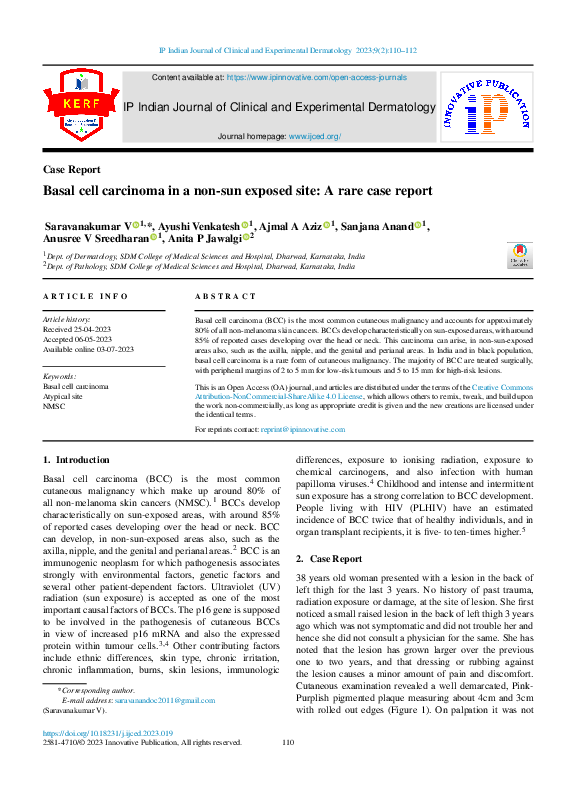(PDF) Basal cell carcinoma in a non-sun exposed site: A rare case report