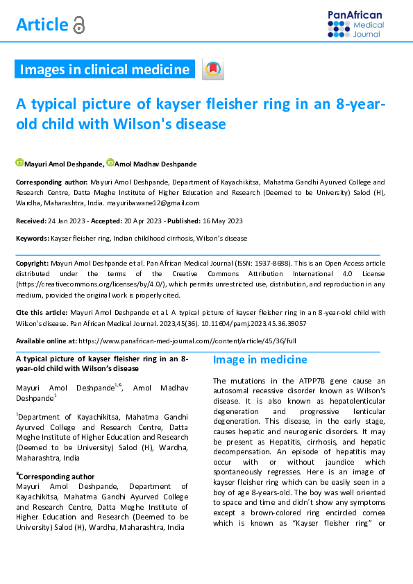 (PDF) A typical picture of kayser fleisher ring in an 8-year-old child ...