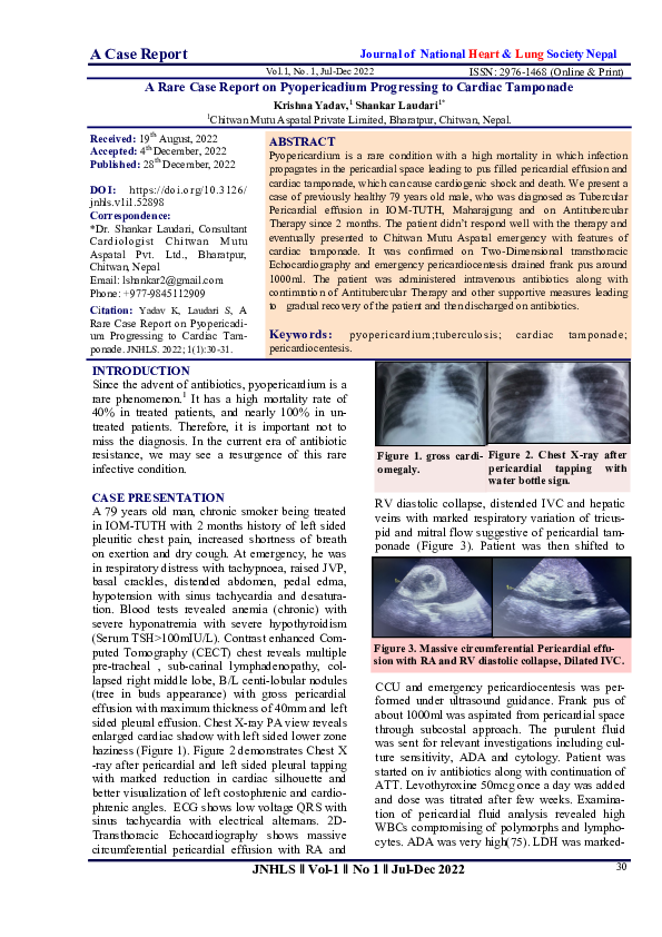 (PDF) A Rare Case Report on Pyopericadium Progressing to Cardiac Tamponade
