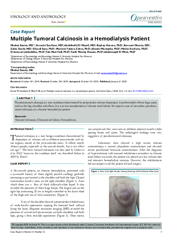 (PDF) Multiple Tumoral Calcinosis in a Hemodialysis Patient