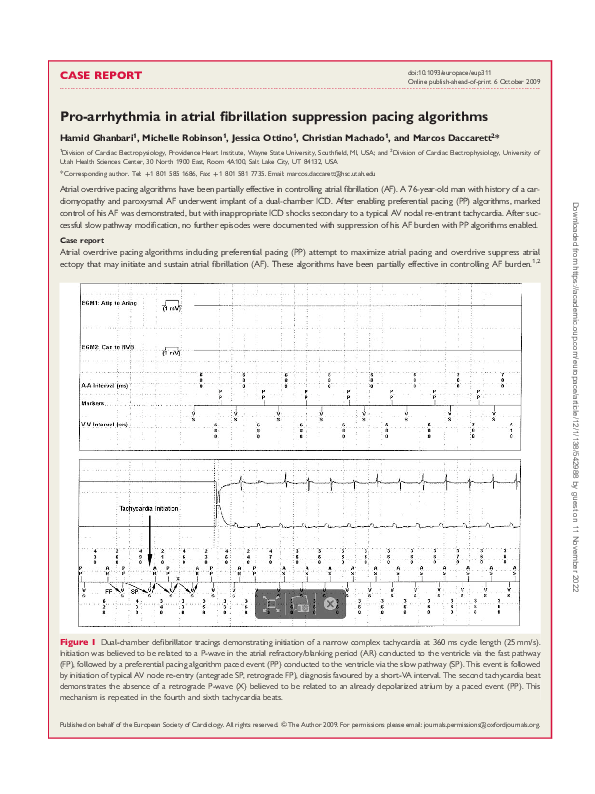 (PDF) Pro-arrhythmia in atrial fibrillation suppression pacing algorithms