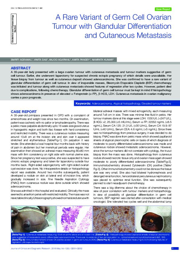 (PDF) A Rare Variant of Germ Cell Ovarian Tumour with Glandular ...