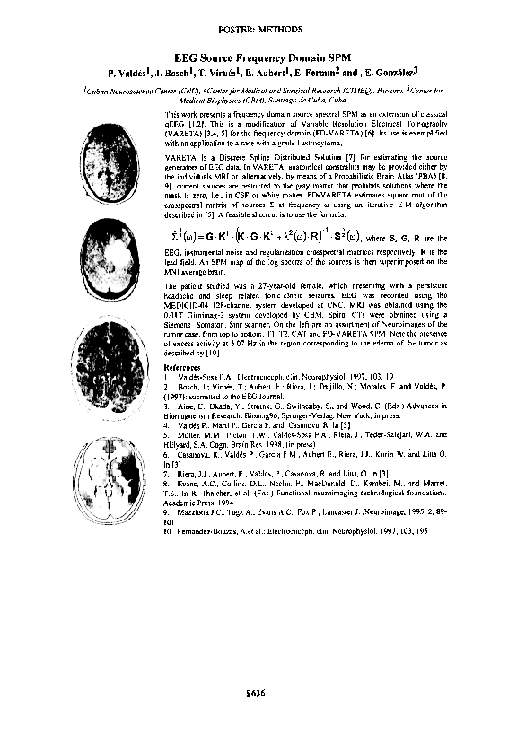 (PDF) EEG Source Frequency Domain SPM