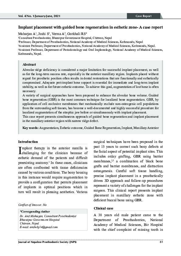 (PDF) Implant placement with guided bone regeneration in esthetic zone ...