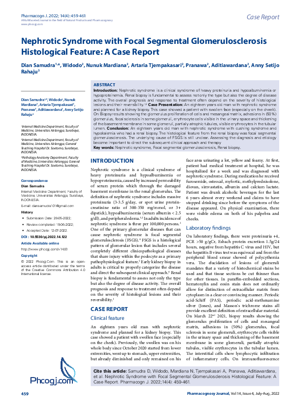 (PDF) Nephrotic Syndrome with Focal Segmental Glomerulosclerosis