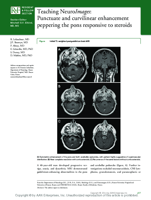 (PDF) Teaching NeuroImages: Punctuate and curvilinear enhancement ...