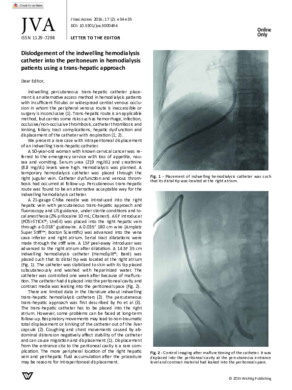(PDF) Dislodgement of the indwelling hemodialysis catheter into the ...
