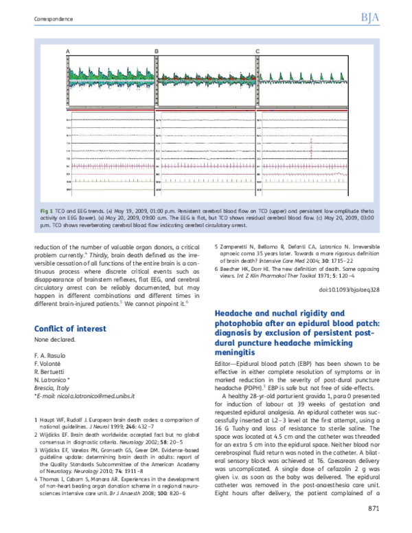 (PDF) Headache and nuchal rigidity and photophobia after an epidural ...