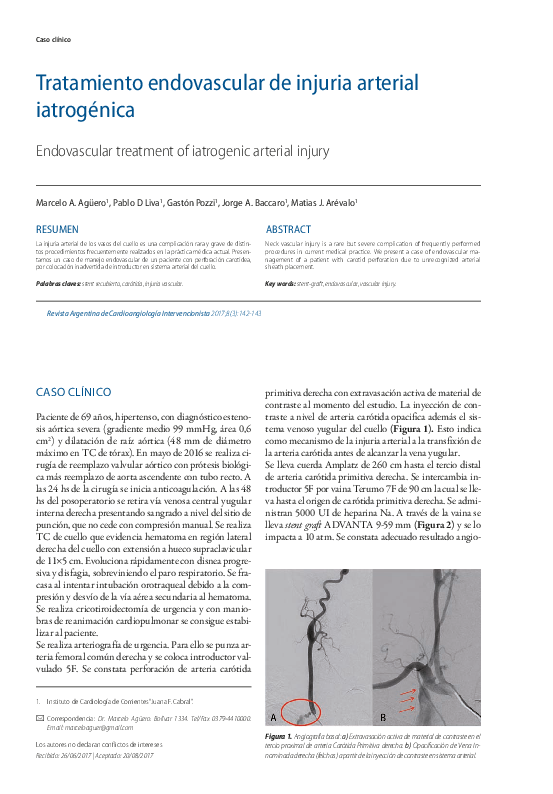 (PDF) Tratamiento endovascular de injuria arterial iatrogénica