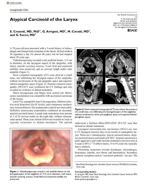 (PDF) Atypical Carcinoid of the Larynx