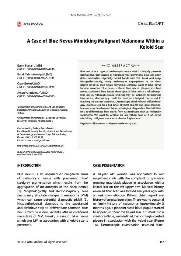 (PDF) A Case of Blue Nevus Mimicking Malignant Melanoma Within a Keloid ...