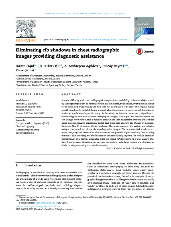 (PDF) Eliminating rib shadows in chest radiographic images providing ...