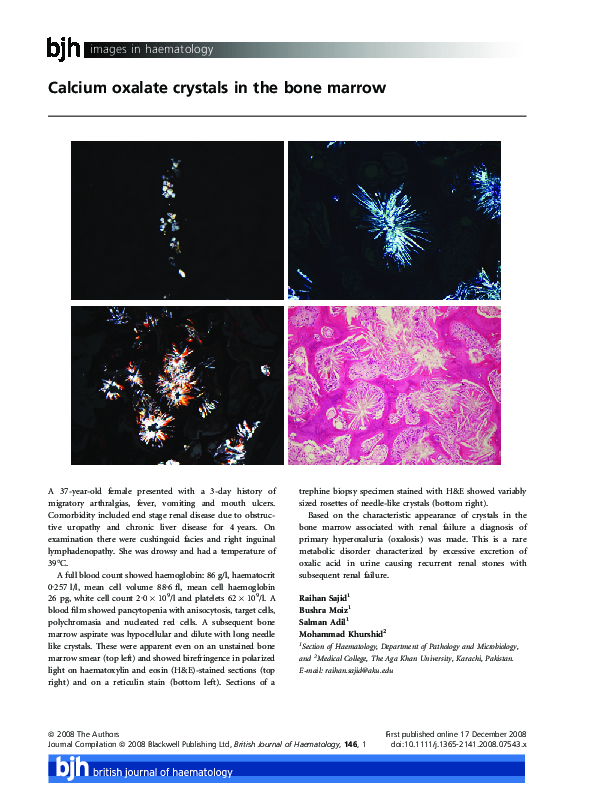(PDF) Calcium oxalate crystals in the bone marrow