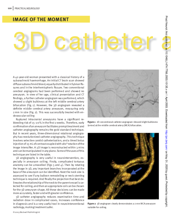 (PDF) 3D Catheter Angiography