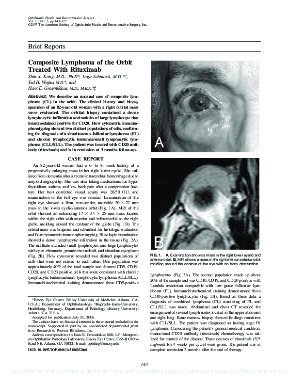 (PDF) Orbital Embryonal Rhabdomyosarcoma in Association with ...
