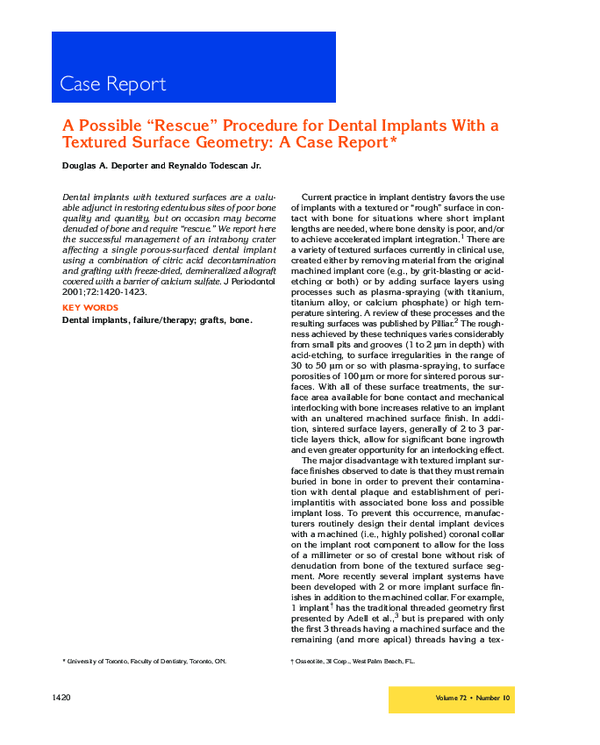 (PDF) A Possible "Rescue" Procedure for Dental Implants With a Textured Surface Geometry A Case
