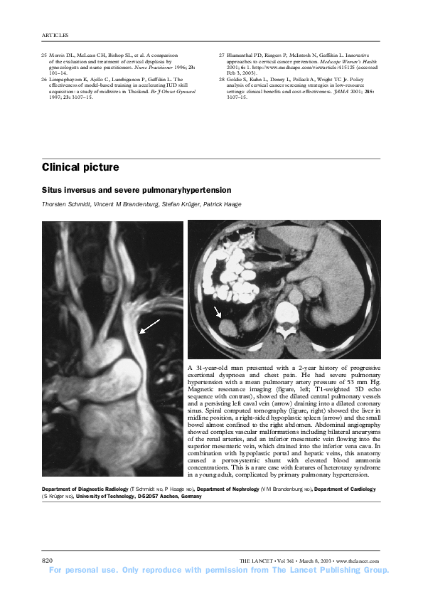 (PDF) Situs inversus and severe pulmonaryhypertension