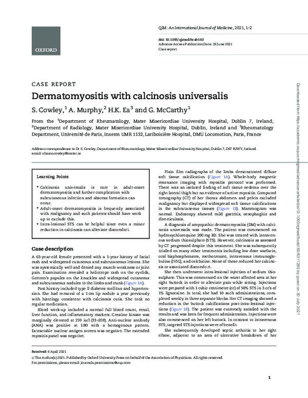 (PDF) Dermatomyositis with calcinosis universalis