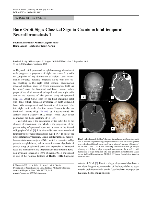 (PDF) Bare Orbit Sign: Classical Sign in Cranio-orbital-temporal ...
